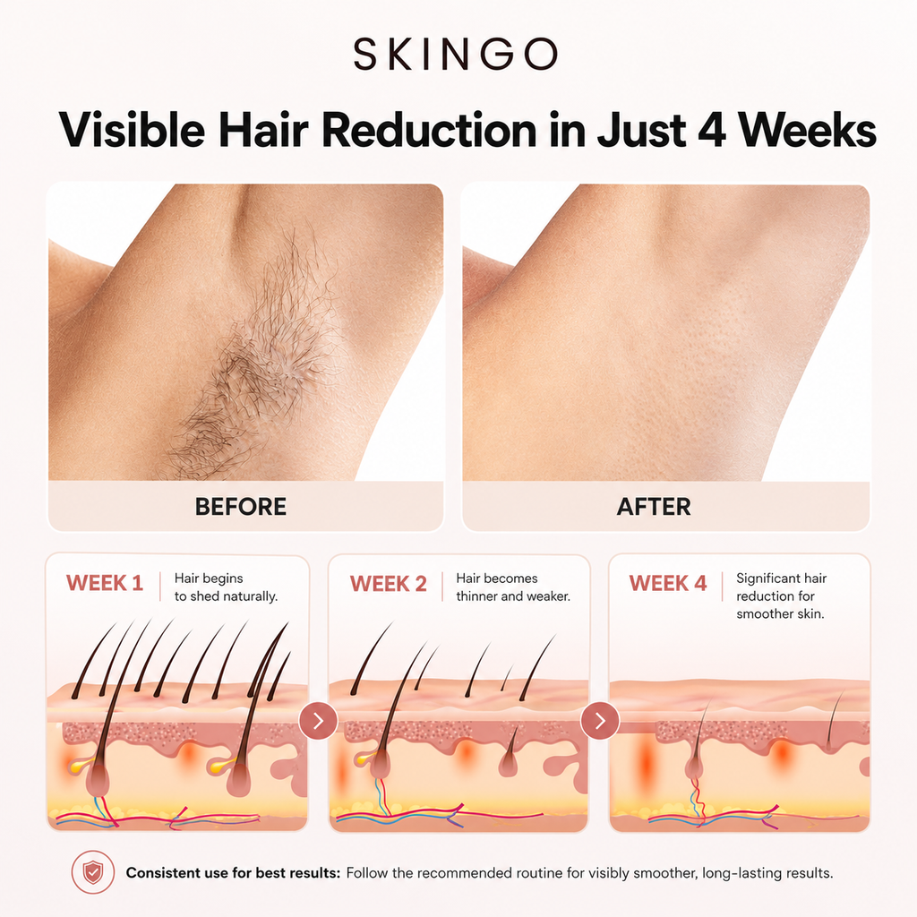 PRO - Skingo Sapphire Iceglow Hair Removal Device